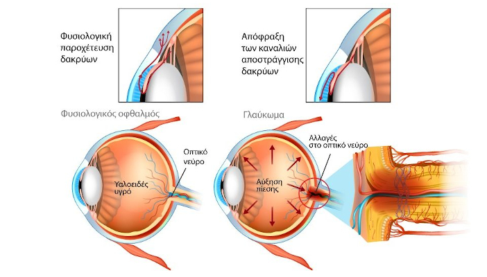 zervopoulos opticians corfu